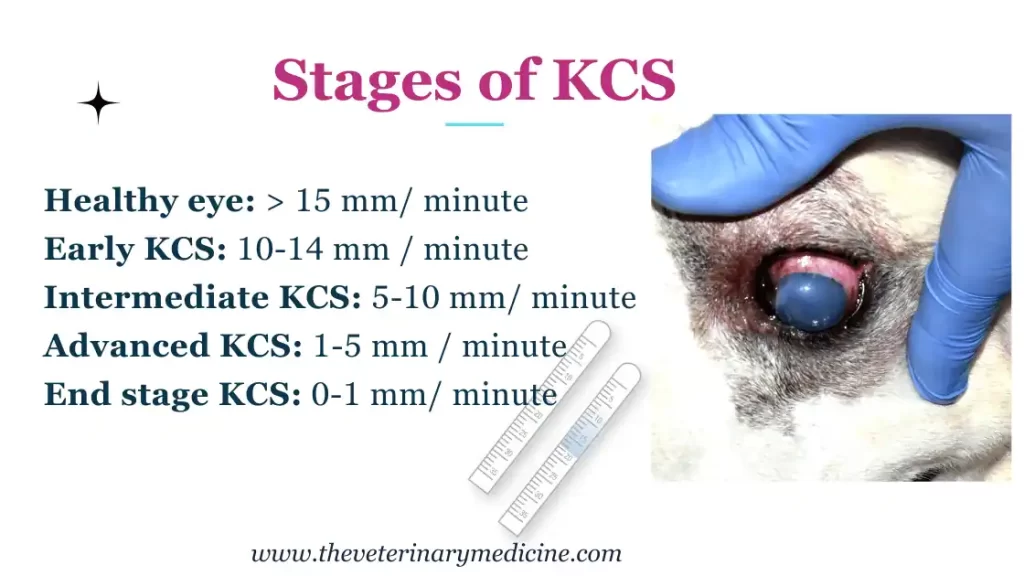 kcs stages and stt values